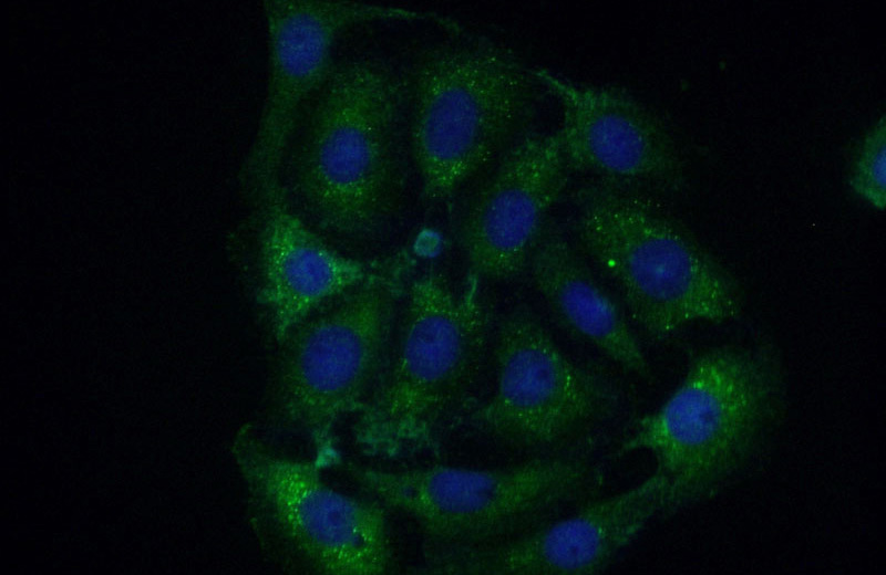 Immunofluorescent analysis of (-20oc Acetone) fixed SH-SY5Y cells using Catalog No:109507(CPEB4 Antibody) at dilution of 1:50 and Alexa Fluor 488-congugated AffiniPure Goat Anti-Rabbit IgG(H+L)