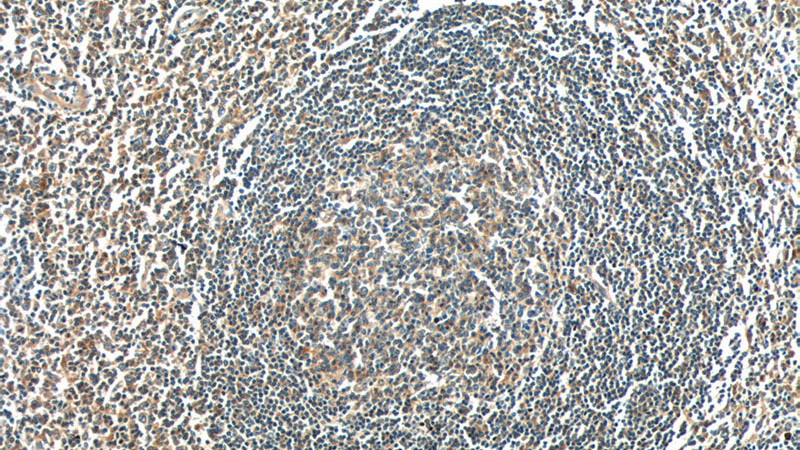 Immunohistochemistry of paraffin-embedded human tonsillitis tissue slide using Catalog No:107769(ADAMDEC1 Antibody) at dilution of 1:50 (under 10x lens)
