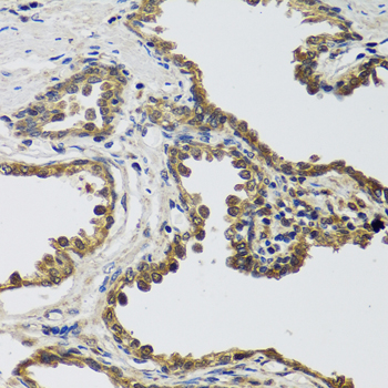 Immunohistochemistry - IL25 Polyclonal Antibody 
