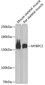 Western blot - MYBPC2 Polyclonal Antibody 