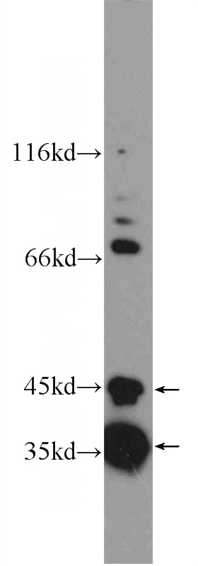 mouse heart tissue were subjected to SDS PAGE followed by western blot with Catalog No:115409(SLMAP Antibody) at dilution of 1:600