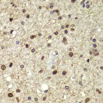 Immunohistochemistry - OCT4 Polyclonal Antibody 