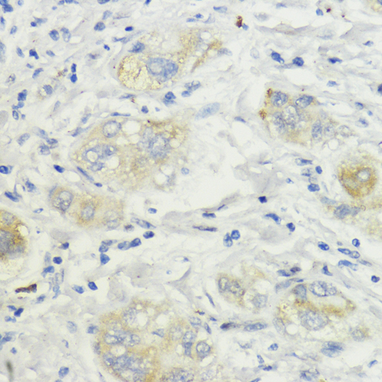 Immunohistochemistry - SURF4 Polyclonal Antibody 