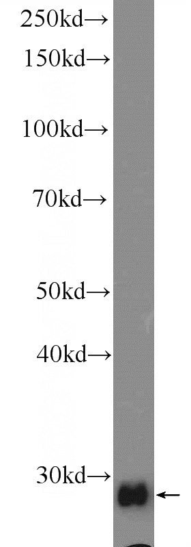 rat liver tissue were subjected to SDS PAGE followed by western blot with Catalog No:111193(GSTT2 Antibody) at dilution of 1:1500
