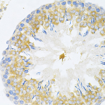 Immunohistochemistry - TAPBP Polyclonal Antibody 