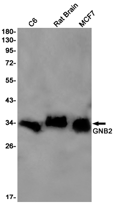 Western blot detection of GNB2 in C6,Rat Brain,MCF7 cell lysates using GNB2 Rabbit pAb(1:1000 diluted).Predicted band size:37kDa.Observed band size:32kDa.