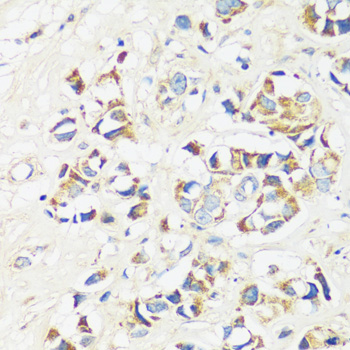 Immunohistochemistry - CADPS Polyclonal Antibody 