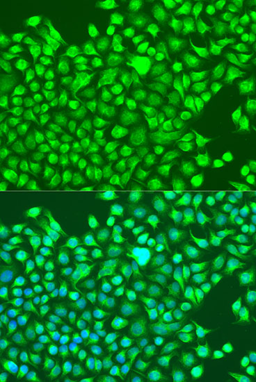 Immunofluorescence - GRIN1 Polyclonal Antibody 