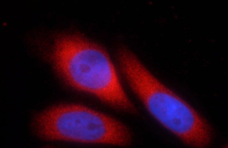 Immunofluorescent analysis of HeLa cells using Catalog No:115508(SOS1 Antibody) at dilution of 1:25 and Rhodamine-Goat anti-Rabbit IgG