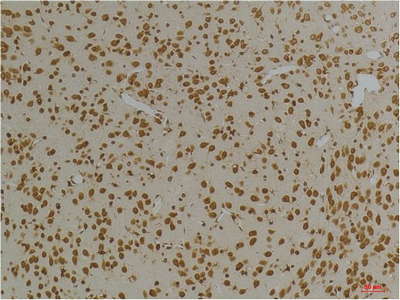 Fig1:; Immunohistochemical analysis of paraffin-embedded Rat BrainTissue using Kv10.1 Rabbit pAb diluted at 1:200.