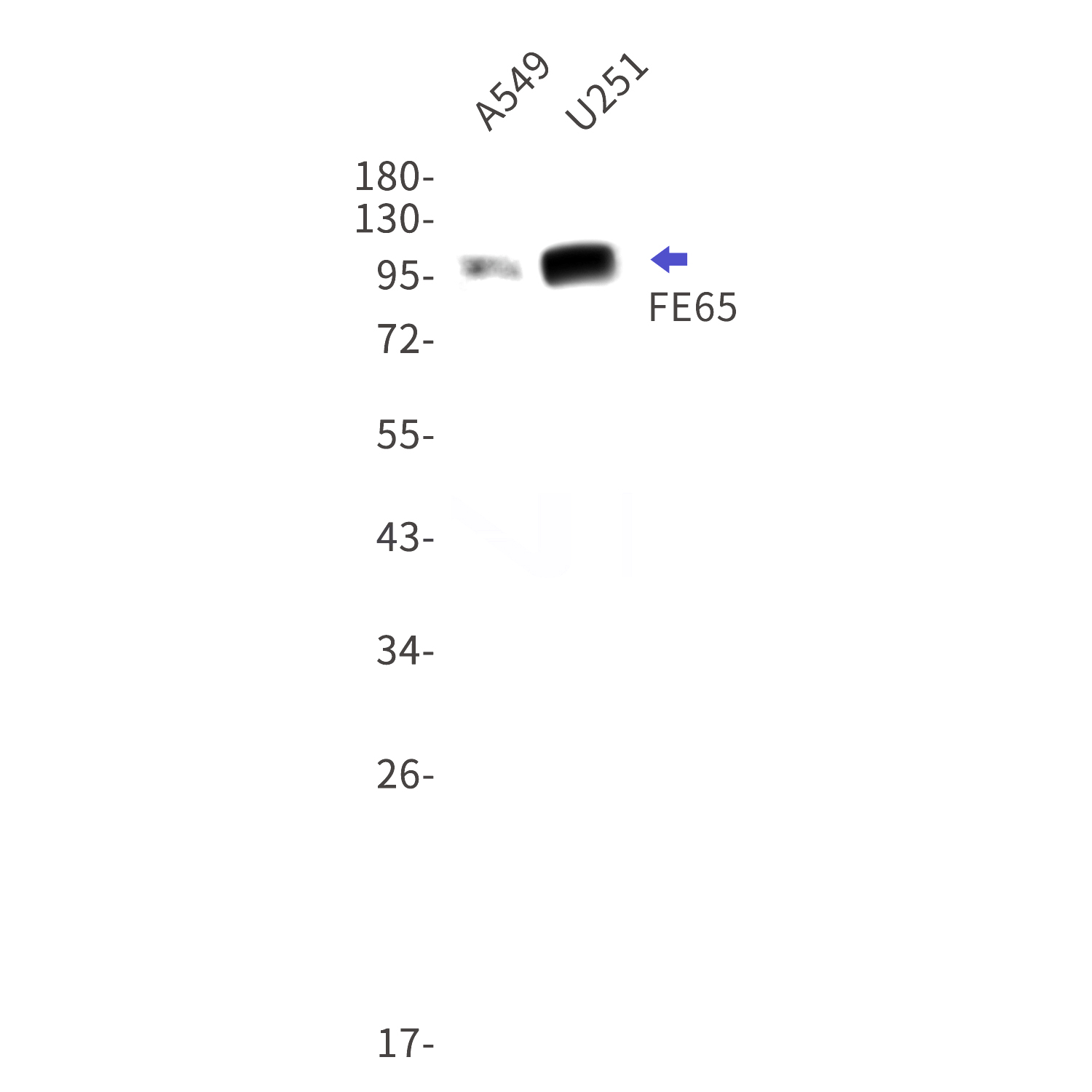 Western blot detection of FE65 in A549,U251 cell lysates using FE65 Rabbit mAb(1:1000 diluted).Predicted band size:77kDa.Observed band size:100kDa.