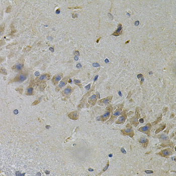 Immunohistochemistry - TLR7 Polyclonal Antibody 