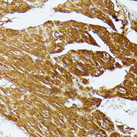 Immunohistochemistry - COX15 Polyclonal Antibody 