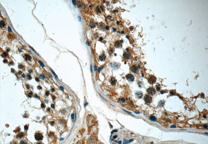 Immunohistochemistry of paraffin-embedded human testis tissue slide using Catalog No:107037(CCT3 Antibody) at dilution of 1:50
