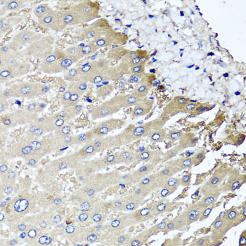 Immunohistochemistry - MGAT1 Polyclonal Antibody 