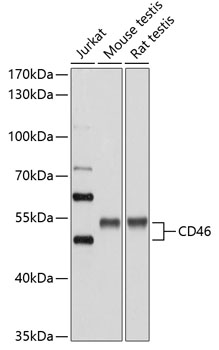 Western blot - CD46 Polyclonal Antibody 