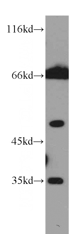 K-562 cells were subjected to SDS PAGE followed by western blot with Catalog No:109293(CHST12 antibody) at dilution of 1:1000