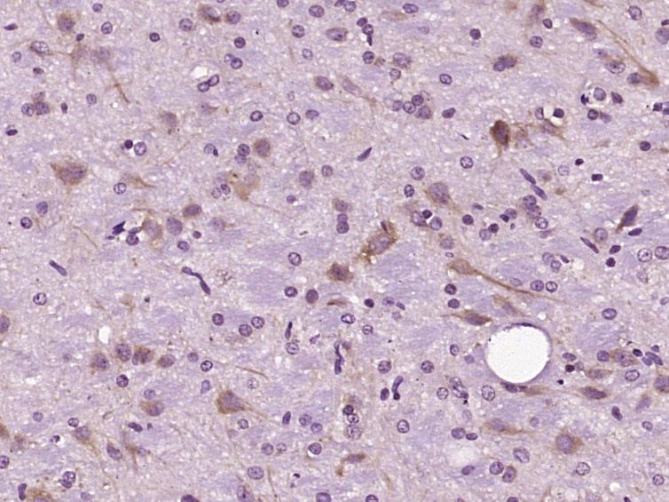 Fig1: Paraformaldehyde-fixed, paraffin embedded (Rat brain); Antigen retrieval by boiling in sodium citrate buffer (pH6.0) for 15min; Block endogenous peroxidase by 3% hydrogen peroxide for 20 minutes; Blocking buffer (normal goat serum) at 37℃ for 30min; Antibody incubation with (DIO2) Polyclonal Antibody, Unconjugated at 1:400 overnight at 4℃, followed by operating according to SP Kit(Rabbit) (sp-0023) instructions and DAB staining.