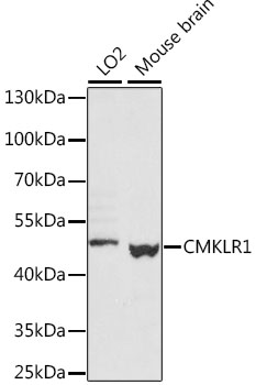 Western blot - CMKLR1 Polyclonal Antibody 