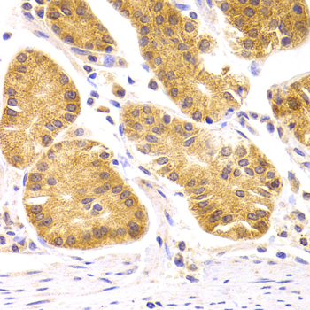 Immunohistochemistry - SCO2 Polyclonal Antibody 