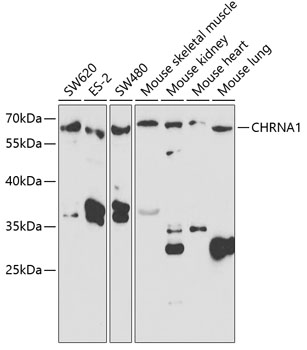 Western blot - CHRNA1 Polyclonal Antibody 