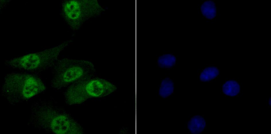 Fig2:; ICC staining of TNPO3 in A549 cells (green). Formalin fixed cells were permeabilized with 0.1% Triton X-100 in TBS for 10 minutes at room temperature and blocked with 1% Blocker BSA for 15 minutes at room temperature. Cells were probed with the primary antibody ( 1/50) for 1 hour at room temperature, washed with PBS. Alexa Fluor®488 Goat anti-Rabbit IgG was used as the secondary antibody at 1/1,000 dilution. The nuclear counter stain is DAPI (blue).