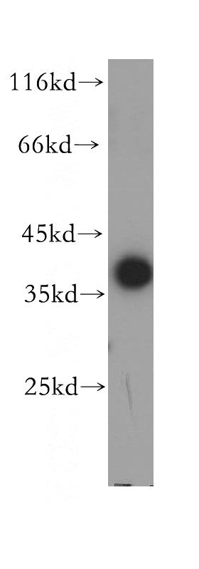 human kidney tissue were subjected to SDS PAGE followed by western blot with Catalog No:112525(MFAP4 antibody) at dilution of 1:600