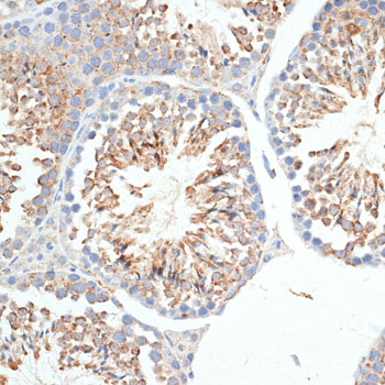 Immunohistochemistry - KLHL9 Polyclonal Antibody 