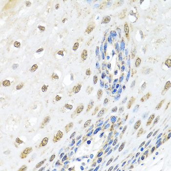 Immunohistochemistry - ELAC2 Polyclonal Antibody 