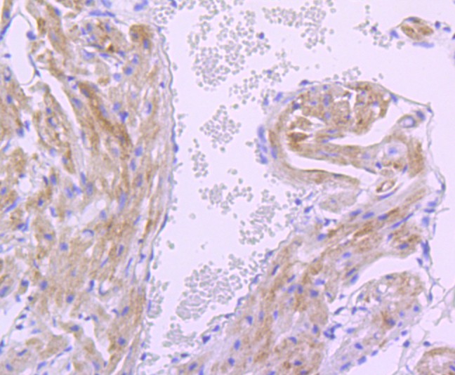 Fig5:; Immunohistochemical analysis of paraffin-embedded mouse heart tissue using anti-PDK1 antibody. The section was pre-treated using heat mediated antigen retrieval with Tris-EDTA buffer (pH 8.0-8.4) for 20 minutes.The tissues were blocked in 5% BSA for 30 minutes at room temperature, washed with ddH; 2; O and PBS, and then probed with the primary antibody ( 1/50) for 30 minutes at room temperature. The detection was performed using an HRP conjugated compact polymer system. DAB was used as the chromogen. Tissues were counterstained with hematoxylin and mounted with DPX.