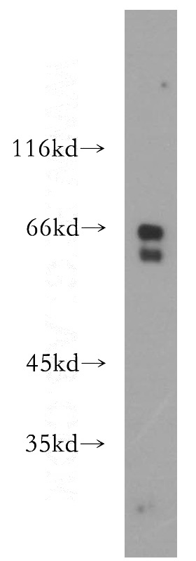 Y79 cells were subjected to SDS PAGE followed by western blot with Catalog No:114802(RPE65 antibody) at dilution of 1:600