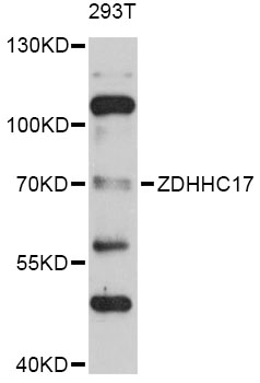 Western blot - ZDHHC17 Polyclonal Antibody 