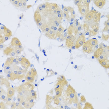 Immunohistochemistry - CLIP1 Polyclonal Antibody 