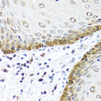Immunohistochemistry - BMP5 Polyclonal Antibody 
