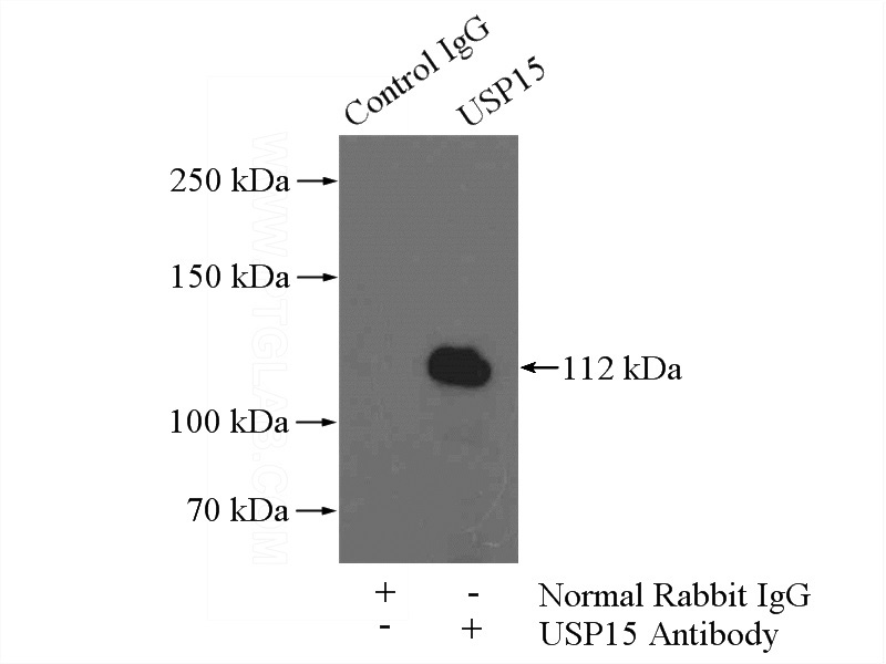 IP Result of anti-USP15 (IP:Catalog No:116592, 4ug; Detection:Catalog No:116592 1:1000) with mouse brain tissue lysate 4000ug.