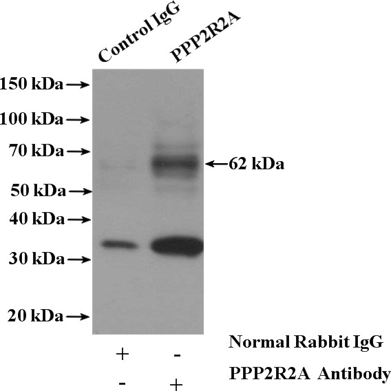 IP Result of anti-PPP2R2A (IP:Catalog No:114099, 4ug; Detection:Catalog No:114099 1:500) with mouse brain tissue lysate 4000ug.