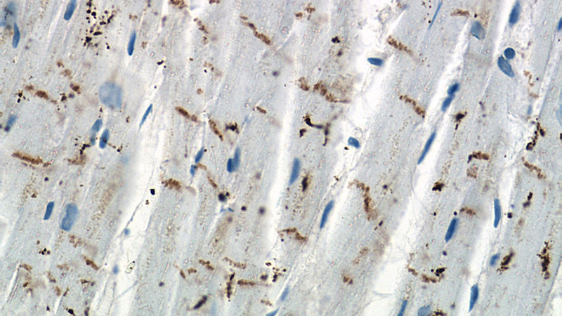 Immunohistochemistry of paraffin-embedded human heart tissue slide using (N-cadherin Antibody) at dilution of 1:200 (under 40x lens)