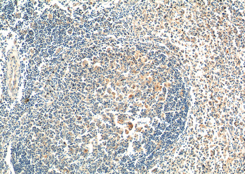 Immunohistochemistry of paraffin-embedded human spleen tissue slide using Catalog No:114254(PSPH Antibody) at dilution of 1:100 (under 10x lens).