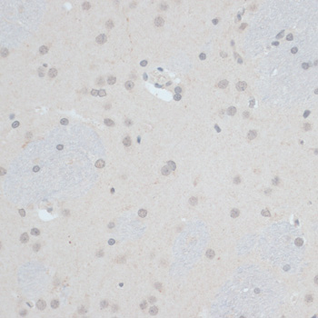 Immunohistochemistry - ZNF703 Polyclonal Antibody 
