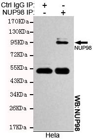 Immunoprecipitation analysis of Hela cell lysates using NUP98 mouse mAb.