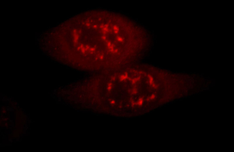 Immunofluorescent analysis of Hela cells, using IL18 antibody Catalog No: at 1:25 dilution and Rhodamine-labeled goat anti-mouse IgG (red).