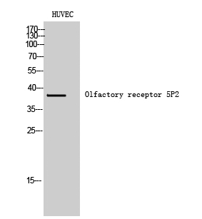 Fig1:; Western Blot analysis of HUVEC cells using Olfactory receptor 5P2 Polyclonal Antibody