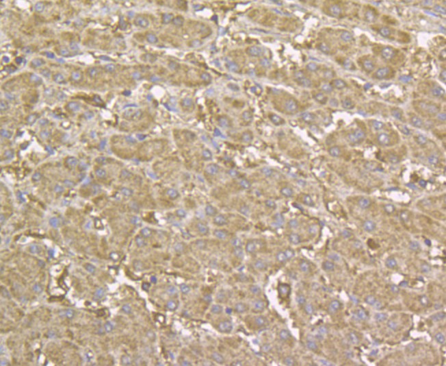 Fig3:; Immunohistochemical analysis of paraffin-embedded human liver tissue using anti-YKL-40 / CHI3L1 antibody. The section was pre-treated using heat mediated antigen retrieval with sodium citrate buffer (pH 6.0) for 20 minutes. The tissues were blocked in 5% BSA for 30 minutes at room temperature, washed with ddH; 2; O and PBS, and then probed with the antibody at 1/200 dilution, for 30 minutes at room temperature and detected using an HRP conjugated compact polymer system. DAB was used as the chrogen. Counter stained with hematoxylin and mounted with DPX.