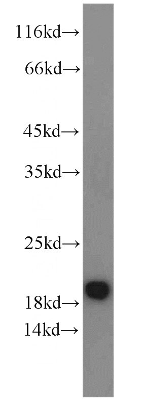 mouse brain tissue were subjected to SDS PAGE followed by western blot with Catalog No:108244(ARF3 antibody) at dilution of 1:800