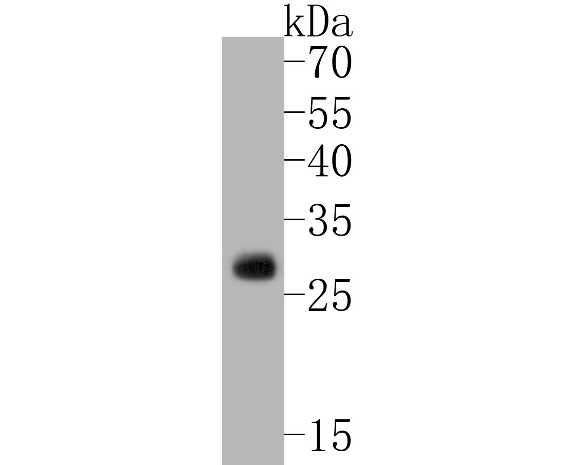 Fig1:; Western blot analysis of TREM2 on mouse brain tissue lysates. Proteins were transferred to a PVDF membrane and blocked with 5% BSA in PBS for 1 hour at room temperature. The primary antibody ( 1/500) was used in 5% BSA at room temperature for 2 hours. Goat Anti-Rabbit IgG - HRP Secondary Antibody (HA1001) at 1:5,000 dilution was used for 1 hour at room temperature.