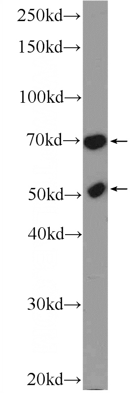 K-562 cells were subjected to SDS PAGE followed by western blot with Catalog No:110448(FLAD1 Antibody) at dilution of 1:600
