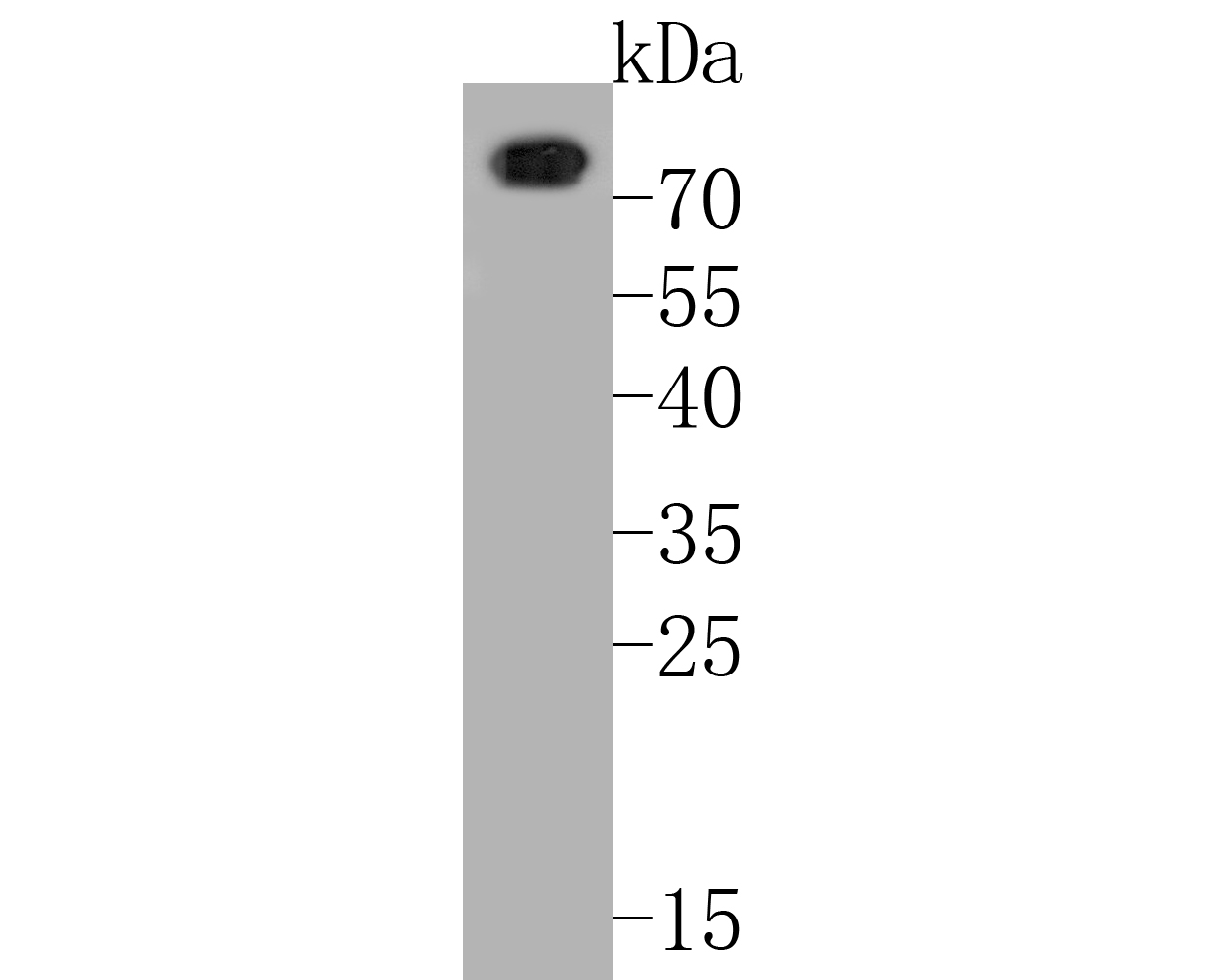 Fig1:; Western blot analysis of CD68 on human spleen tissue lysates. Proteins were transferred to a PVDF membrane and blocked with 5% BSA in PBS for 1 hour at room temperature. The primary antibody ( 1/500) was used in 5% BSA at room temperature for 2 hours. Goat Anti-Rabbit IgG - HRP Secondary Antibody (HA1001) at 1:5,000 dilution was used for 1 hour at room temperature.