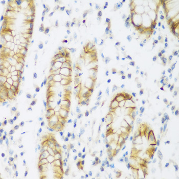 Immunohistochemistry - KIAA1456 Polyclonal Antibody 