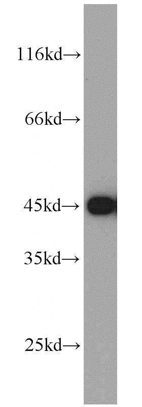 mouse brain tissue were subjected to SDS PAGE followed by western blot with Catalog No:111050(GOT1 antibody) at dilution of 1:1000