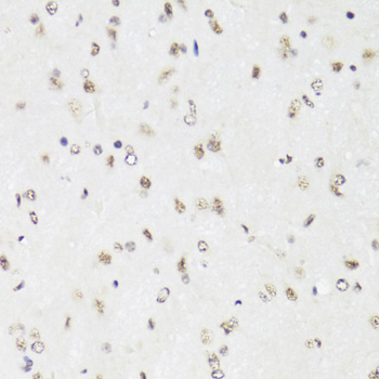 Immunohistochemistry - EFTUD2 Polyclonal Antibody 